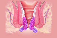 Longo Operation