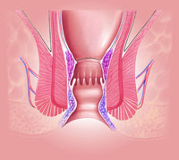 Longo Operation